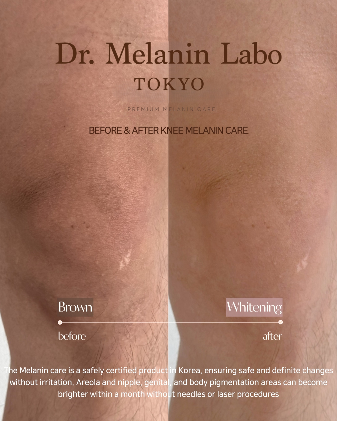 LINE_ALBUM_SNS用写真_260110_2