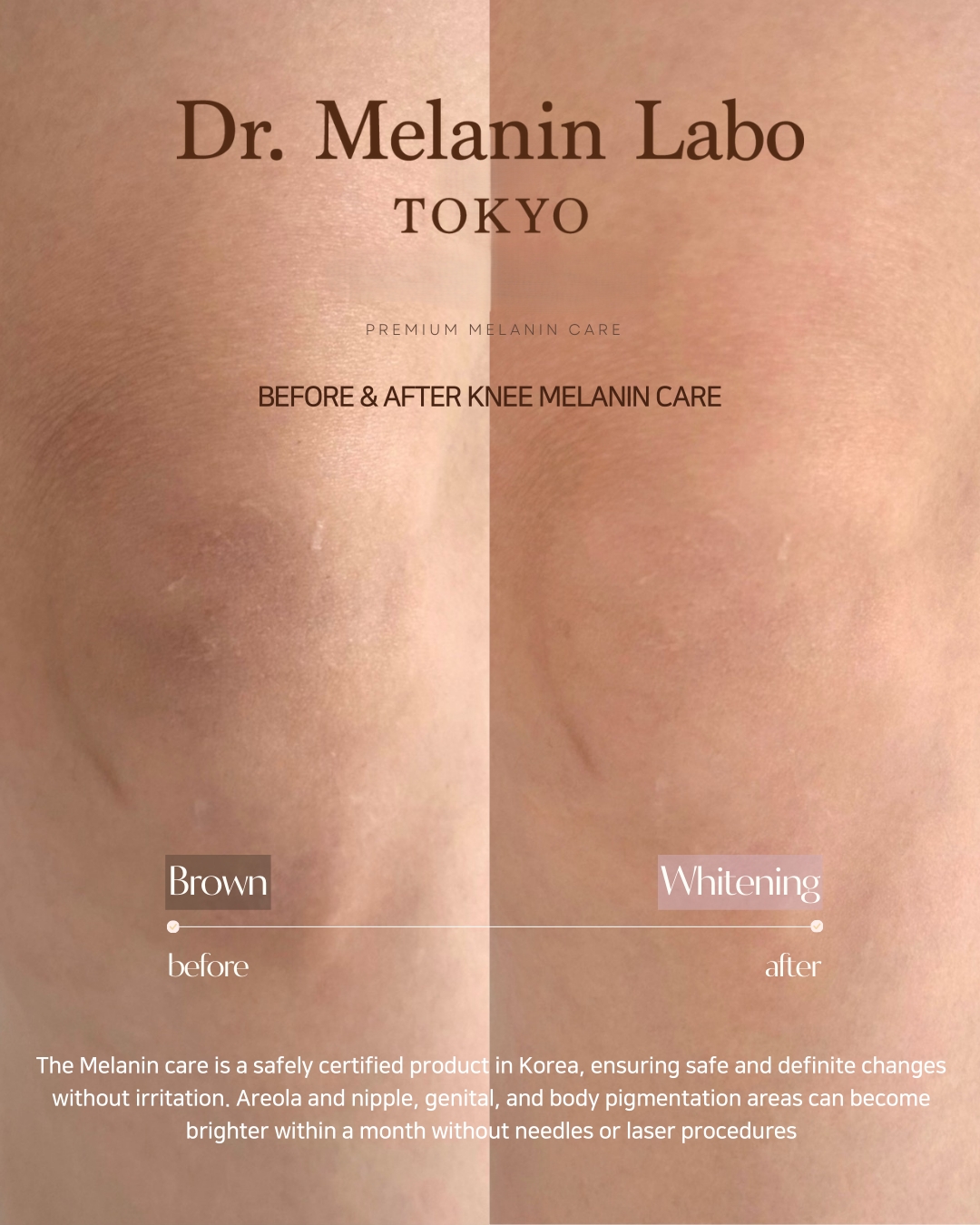 LINE_ALBUM_SNS用写真_260110_3