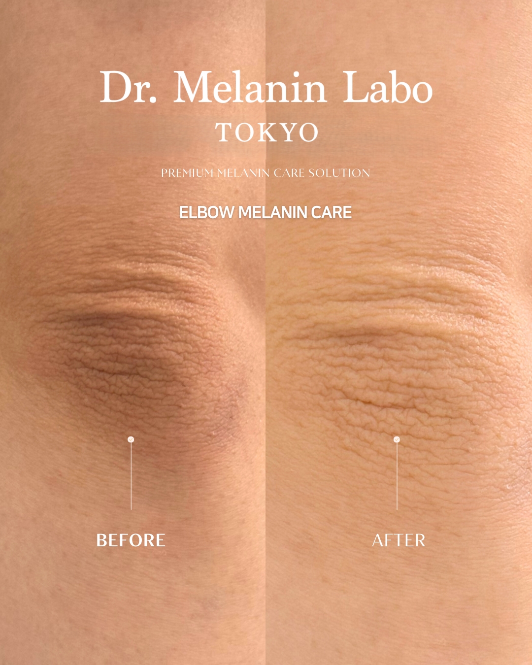 LINE_ALBUM_SNS用写真_260110_4