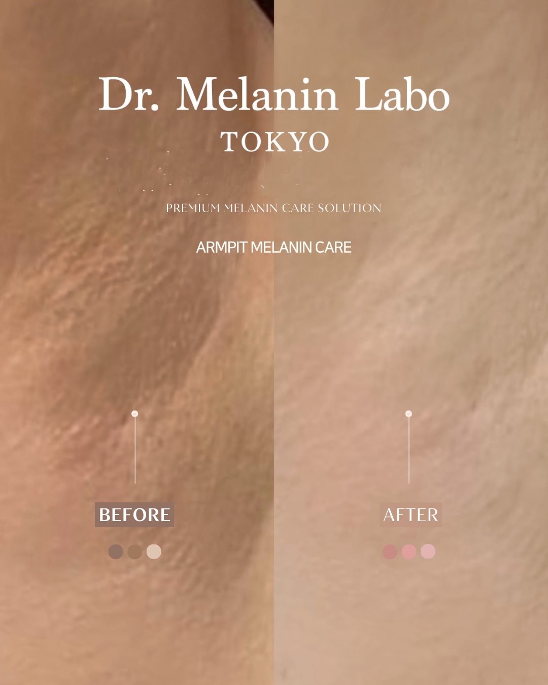 LINE_ALBUM_SNS用写真_260110_5